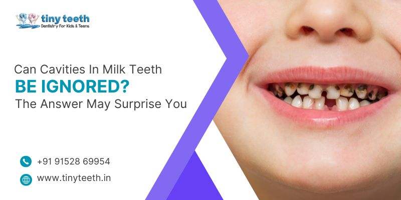 Can Cavities In Milk Teeth Be Ignored The Answer May Surprise You