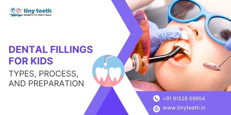 Dental Fillings For Kids Types Process And Preparation