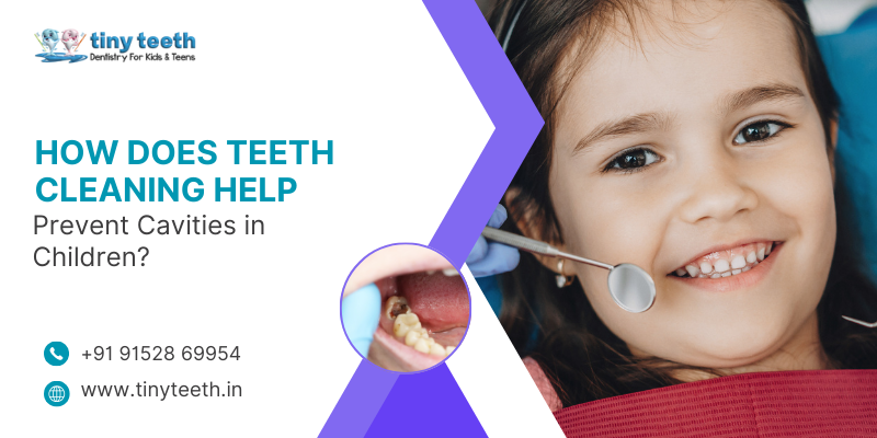 Teeth cleaning for kids in Kurla