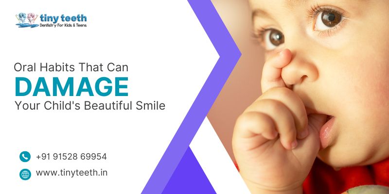 Oral Habits That Can Damage Your Childs Beautiful Smile