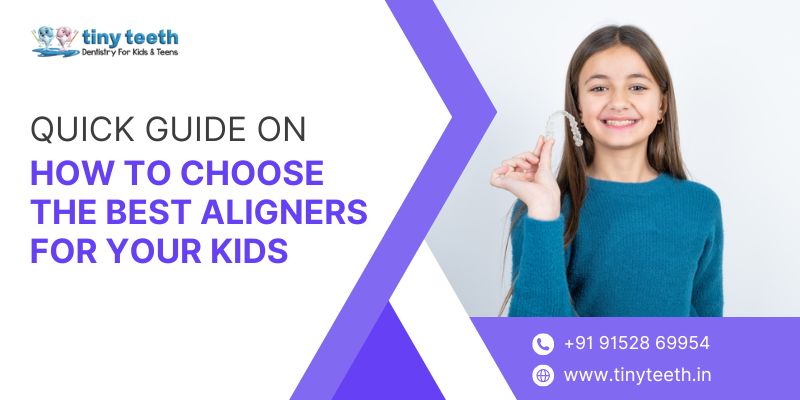 Quick Guide on How to Choose the Best Aligners for Your Kids