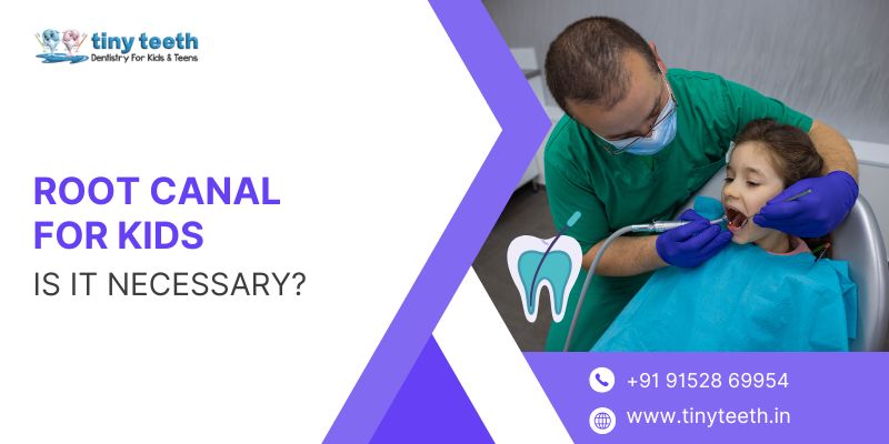 Root Canal for Kids Is It Really Necessary