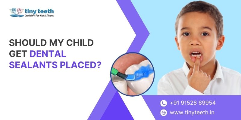 Should My Child Get Dental Sealants Heres What You Need to Know