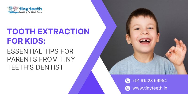 Tooth Extraction for Kids Essential Tips for Parents from Tiny Teeths Dentist