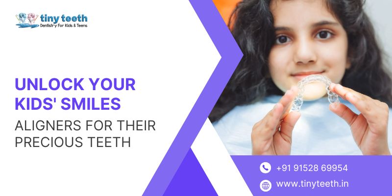Unlock Your Kids Smiles Aligners For Their Precious Teeth